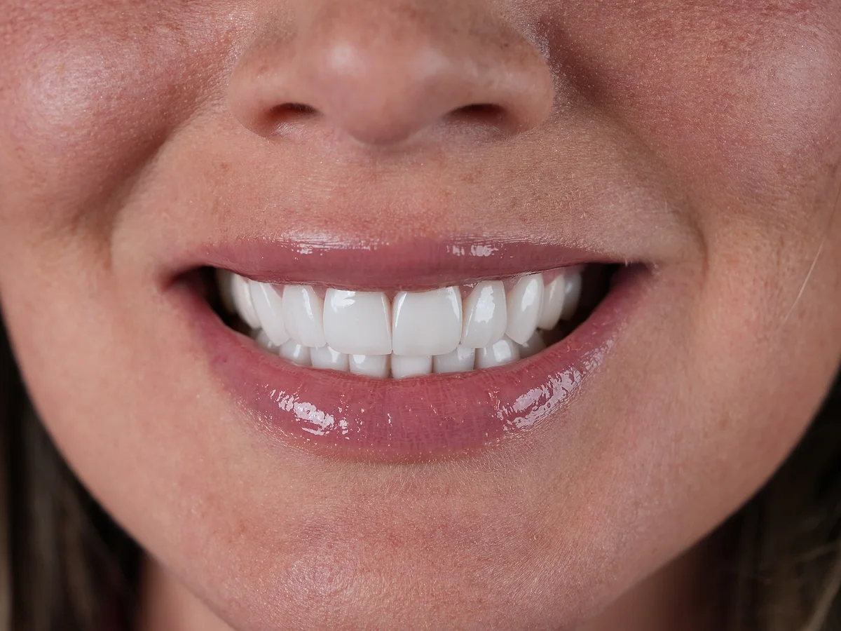 Smile Dental Center