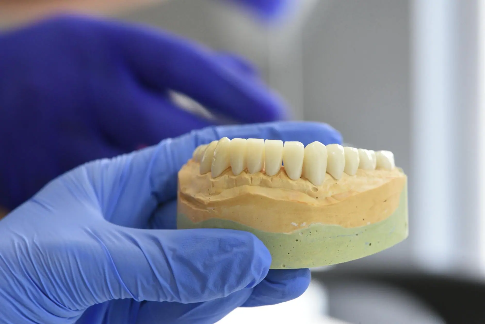 Close-up of a dental model held by gloved hands in a laboratory setting.
