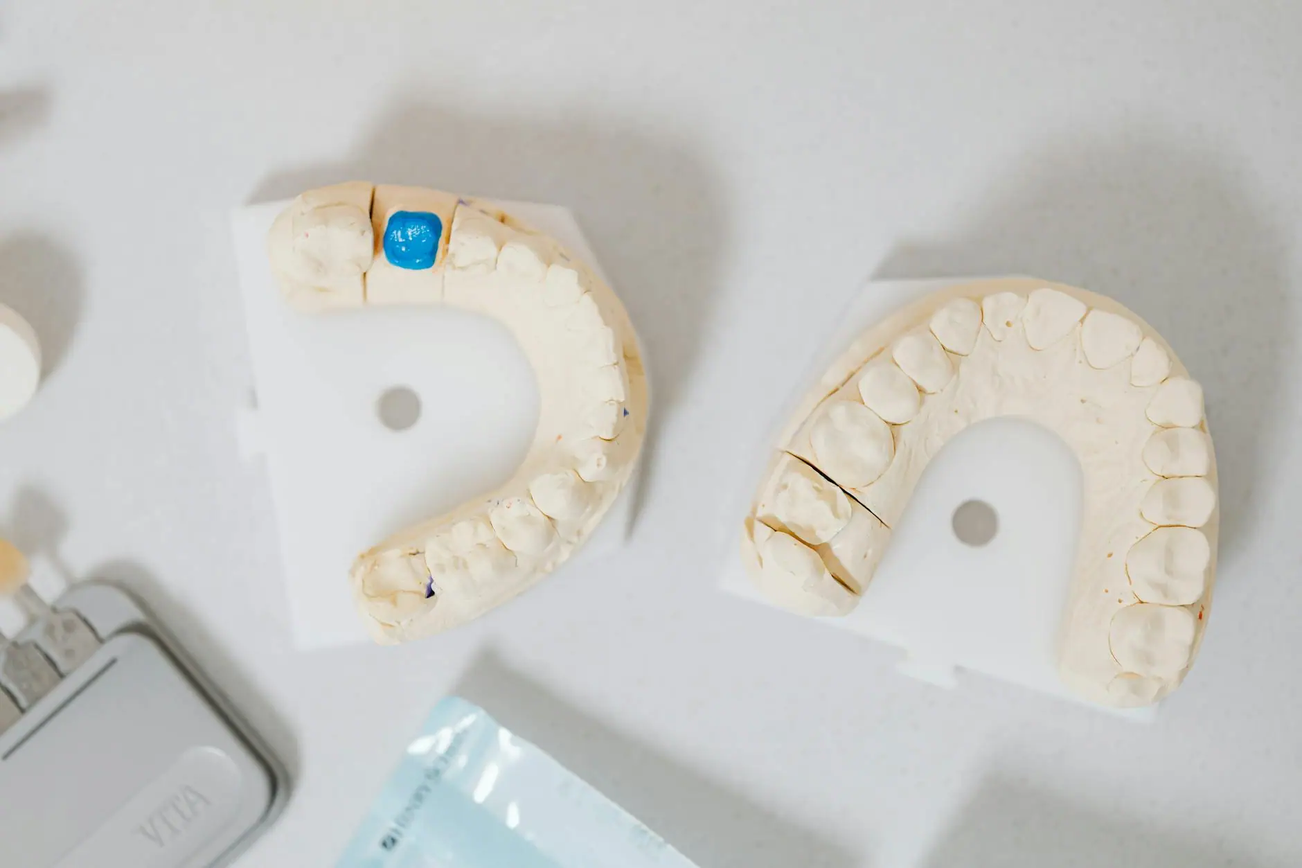Close-up of dental molds on a white table, showcasing orthodontic details.