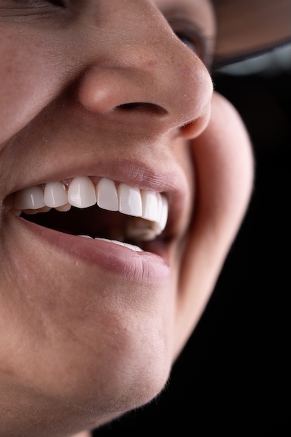 Smile Dental Center