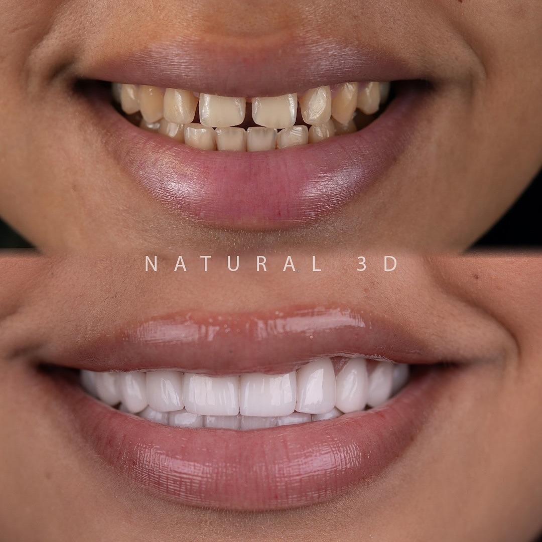 Smile Dental Center