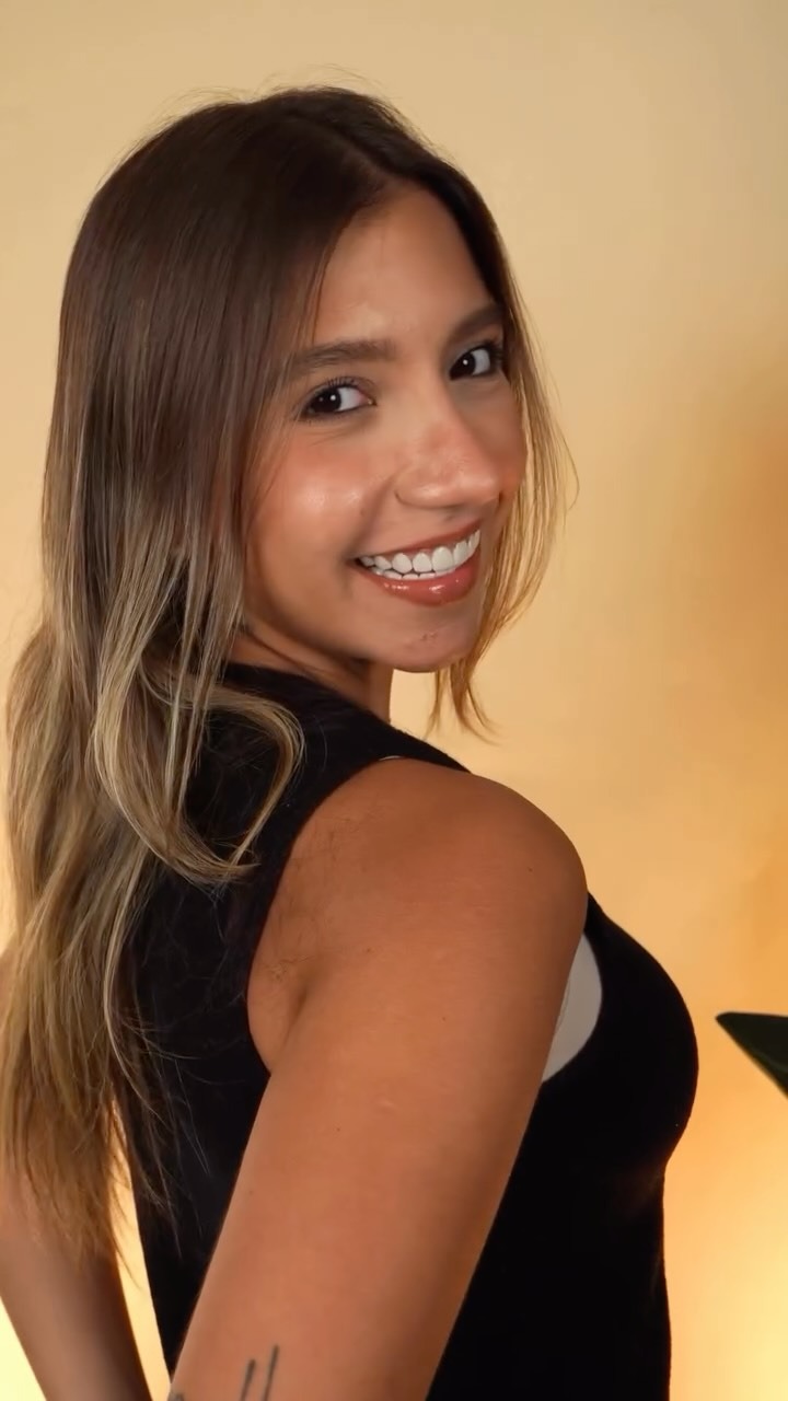 Before — Composite Veneers — Full Set