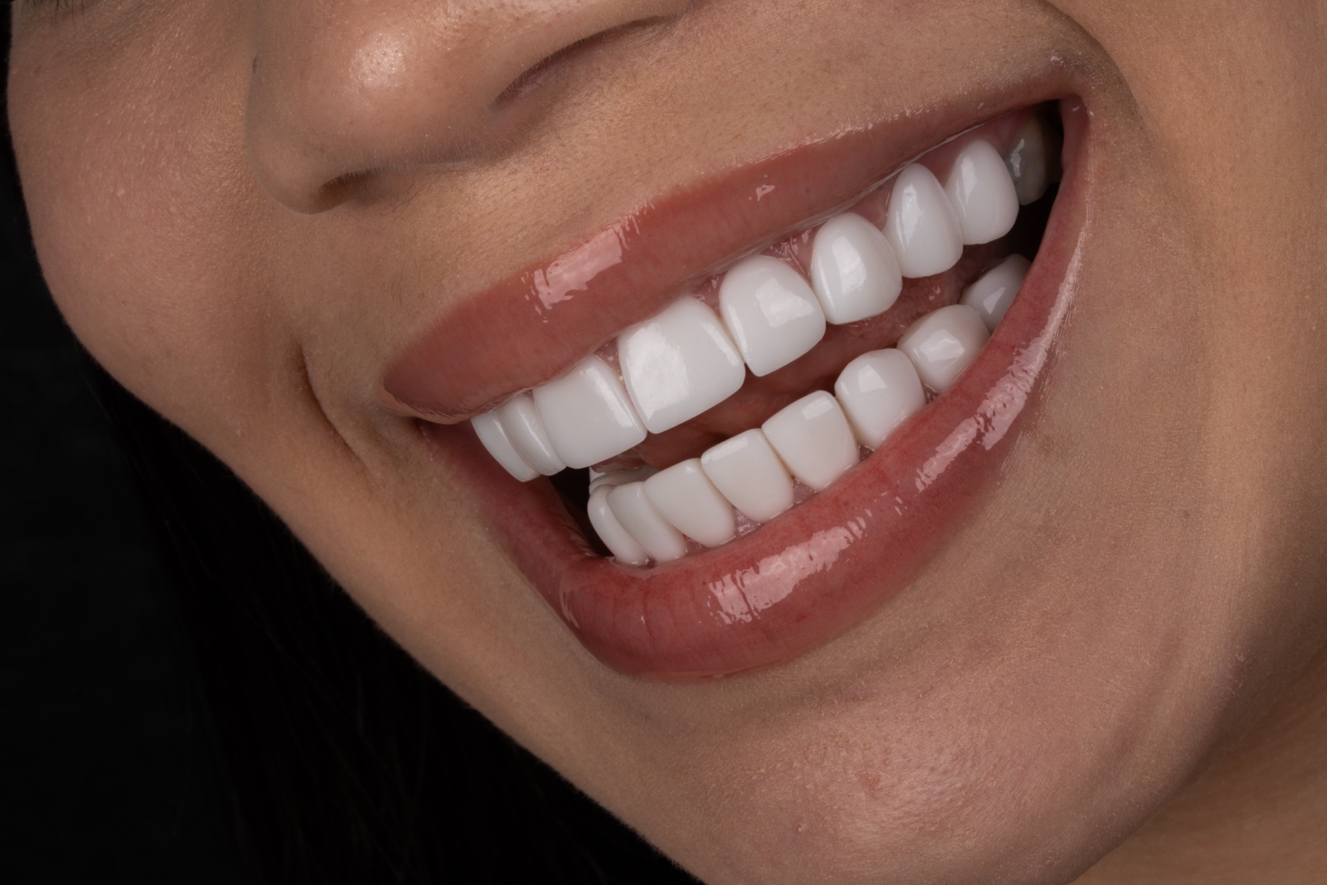 Smile Dental Center