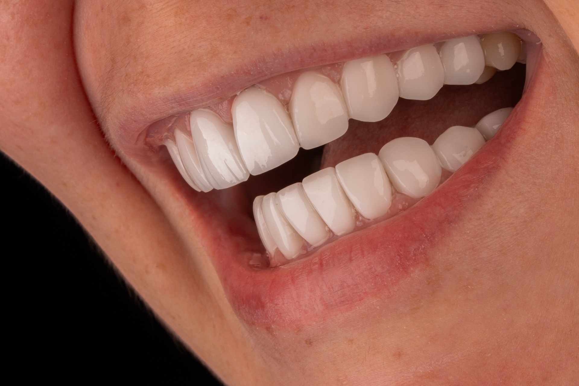 Smile Dental Center