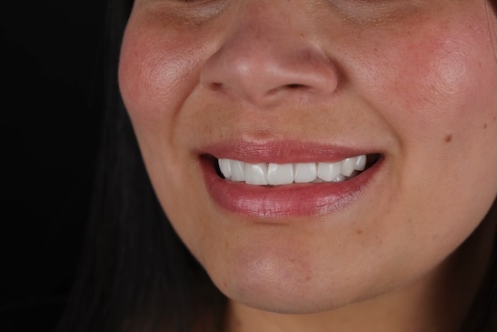 Facetune_22-03-2025-19-01-54