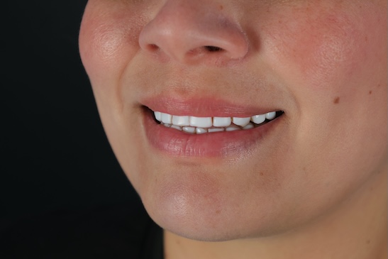 Facetune_22-03-2025-19-02-22