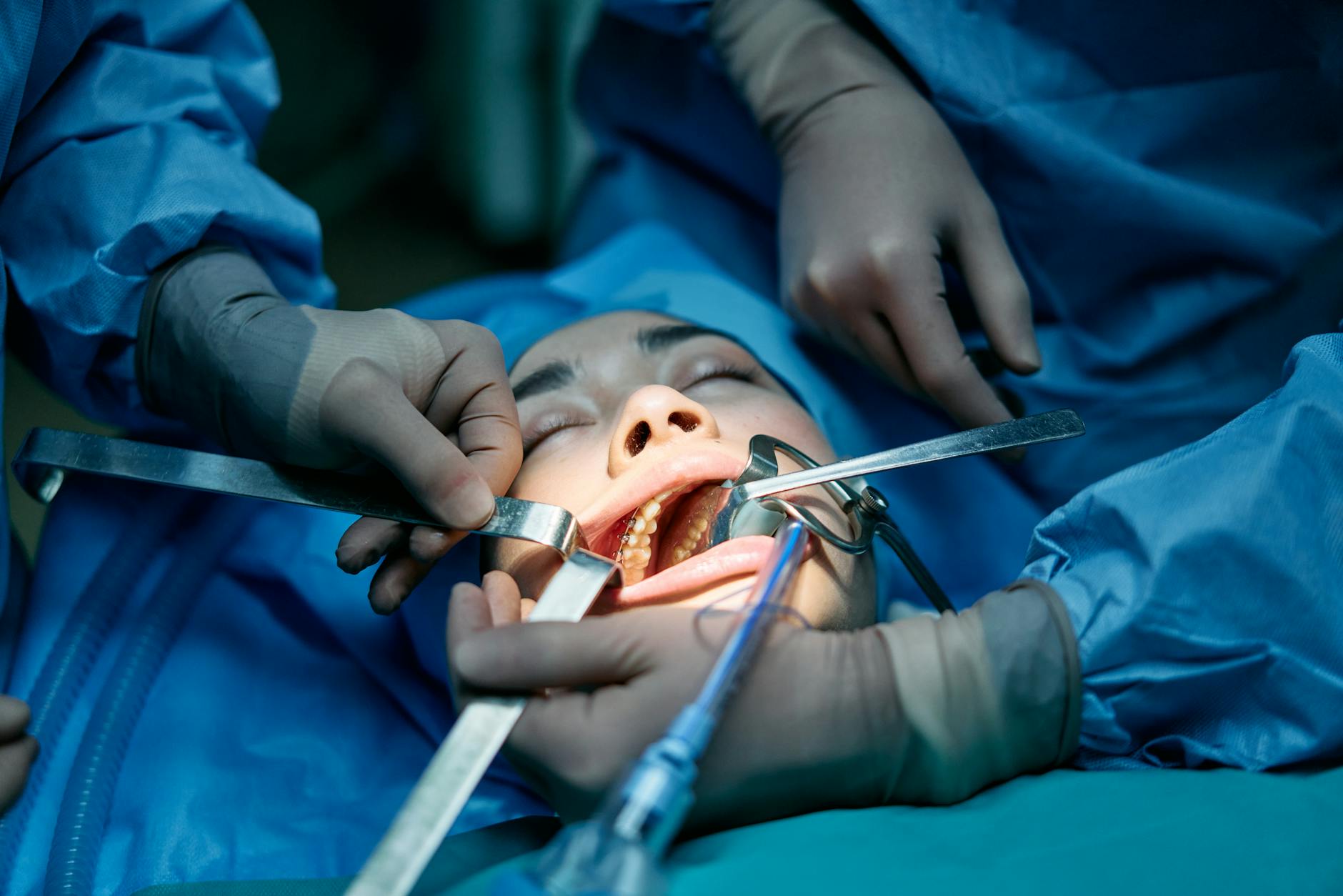 Modern dental operating room prepared for implant surgery in Miami