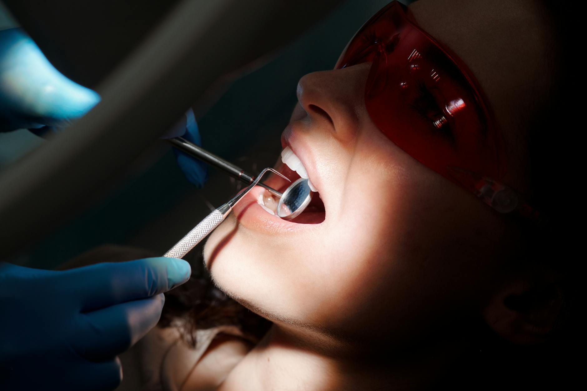 Before and after dark gums? what gum lightening can do results
