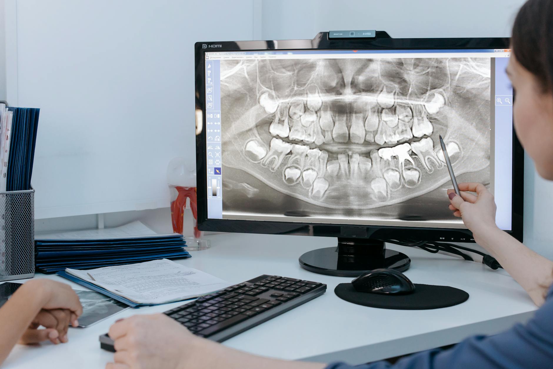 Before and after full mouth x-rays vs panoramic x-ray results