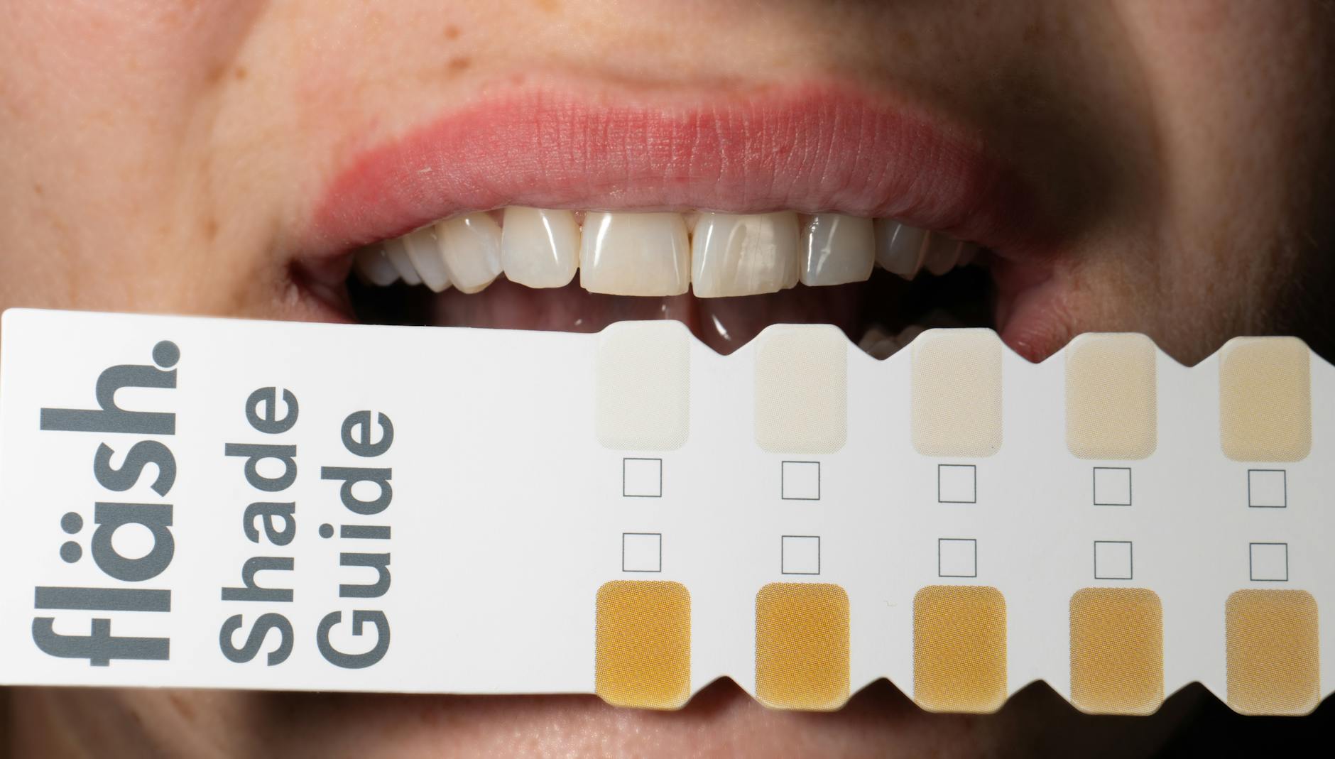 Before and after how to fix gap teeth: veneers, bonding & other options results