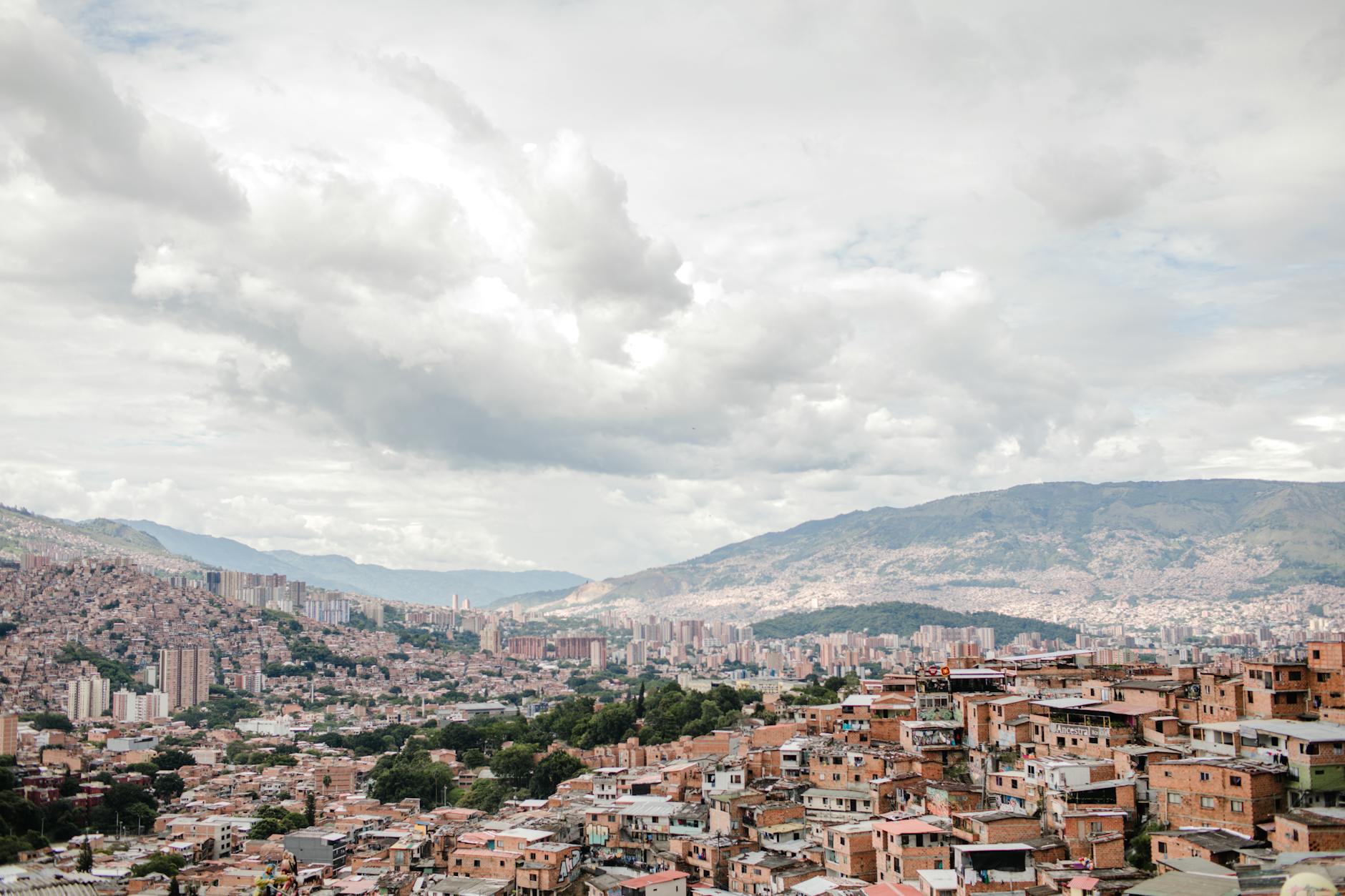 Before and after dental work in colombia: cost, quality & how to plan your trip results