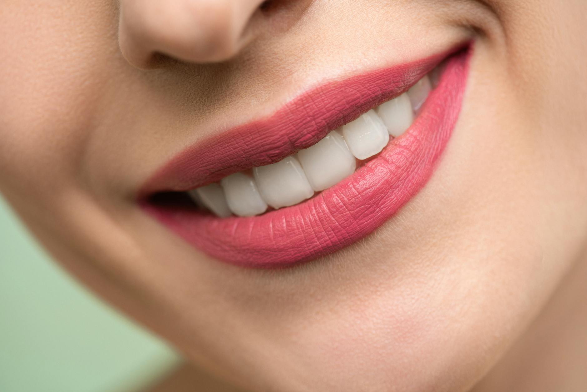 Brilliant white smile result after Philips Zoom treatment