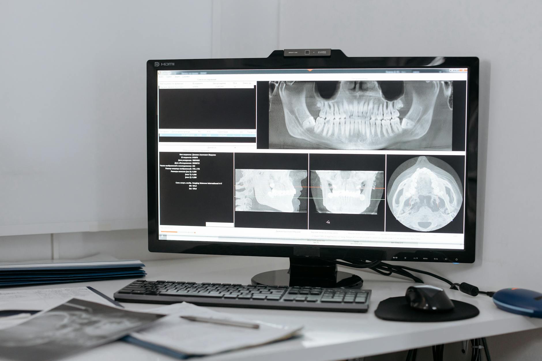 Advanced 3D imaging technology for precise cosmetic dentistry