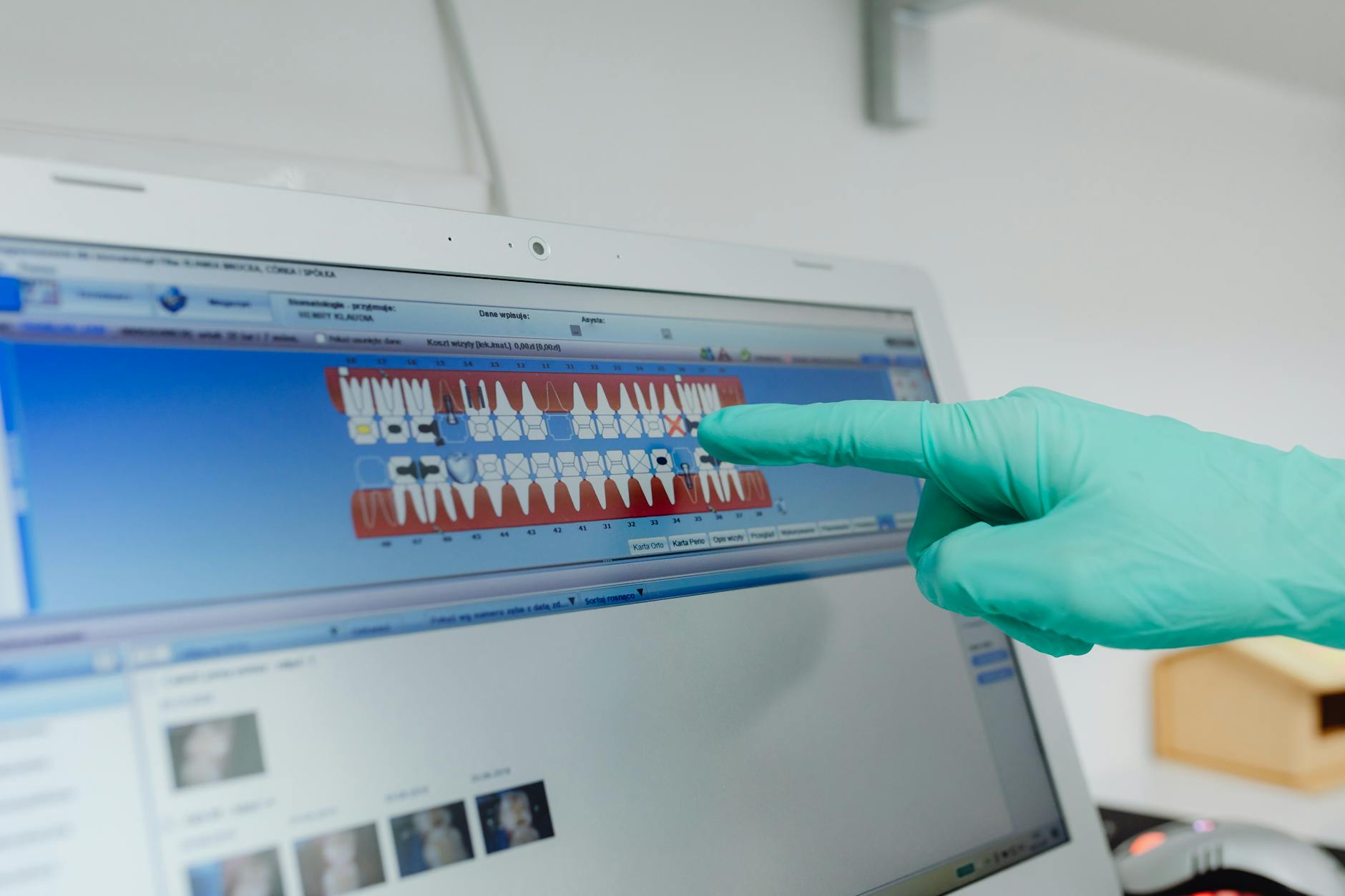 Digital smile design technology showing preview of veneer results